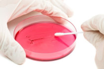 A resist&ecirc;ncia aos antibi&oacute;ticos e as superbact&eacute;rias