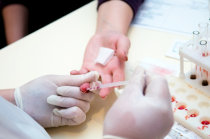 Anemia microcítica Anemia microcítica