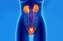 C&aacute;lculo renal: defini&ccedil;&atilde;o, causas, sintomas, diagn&oacute;stico, tratamento e evolu&ccedil;&atilde;o