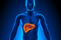 Como é o carcinoma hepatocelular? Como é o carcinoma hepatocelular?