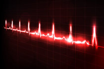 Cintilografia mioc&aacute;rdica