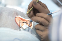 Cirurgia refrativa - conheça mais sobre esse tipo de cirurgia ocular Cirurgia refrativa - conheça mais sobre esse tipo de cirurgia ocular