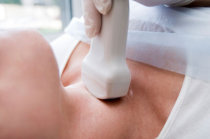 Cisto branquial Cisto branquial