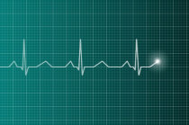 Como &eacute; a assistolia? Tem jeito de prevenir?