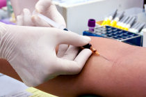 Como &eacute; a policitemia vera?