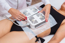 Criolipólise estética: redução da gordura localizada sem cirurgia Criolipólise estética: redução da gordura localizada sem cirurgia