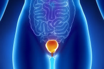 Discinesia vesical - causas, caracter&iacute;sticas cl&iacute;nicas, diagn&oacute;stico, tratamento e poss&iacute;veis complica&ccedil;&otilde;es