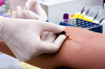 Distúrbios hidroeletrolíticos: o que devemos saber? Distúrbios hidroeletrolíticos: o que devemos saber?