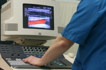 Doppler: como &eacute; este exame? Para que serve?