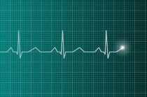 Ecocardiograma: você conhece o exame? Ecocardiograma: você conhece o exame?