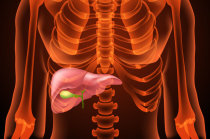 Esteatose metab&oacute;lica