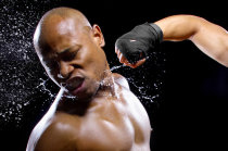 Fratura da mandíbula - como acontece? O que deve ser feito? Fratura da mandíbula - como acontece? O que deve ser feito?