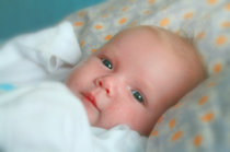 Herpes simples neonatal