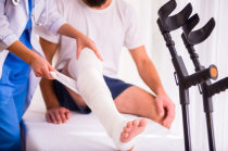 Imobiliza&ccedil;&atilde;o de fraturas &oacute;sseas: como &eacute; feita?