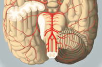 Insuficiência vertebrobasilar: o que é isso? Insuficiência vertebrobasilar: o que é isso?