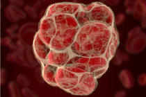 Microangiopatias tromb&oacute;ticas: quando pequenos co&aacute;gulos causam grandes estragos