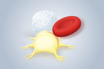 Mieloma m&uacute;ltiplo: saiba mais sobre esta condi&ccedil;&atilde;o