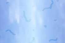 Moscas volantes - o que s&atilde;o? Como elas surgem? O que fazer para evitar?