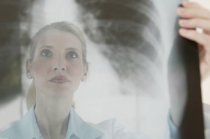 Pneumonia em adultos. Parte II.