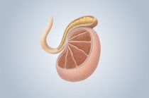 Principais distúrbios testiculares Principais distúrbios testiculares