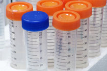 Qual a import&acirc;ncia do exame de urina?