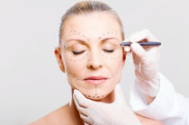 Ritidoplastia ou lifting facial: o que &eacute; isso?