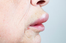 Sinais flog&iacute;sticos - O que eles significam?