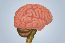 Síndrome Perisylviana - conceito, sintomas, diagnóstico, tratamento Síndrome Perisylviana - conceito, sintomas, diagnóstico, tratamento