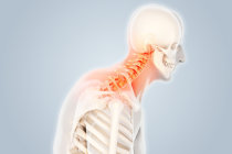 S&iacute;ndrome da costela cervical