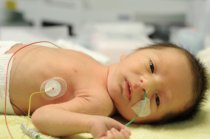 Sofrimento fetal ou hipóxia neonatal: como é? Sofrimento fetal ou hipóxia neonatal: como é?