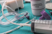 Sonda nasog&aacute;strica - como &eacute; feito o procedimento de coloca&ccedil;&atilde;o da sonda?