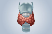 Tratamento com iodo radioativo - o que é importante saber? Tratamento com iodo radioativo - o que é importante saber?