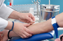 Uremia: conceito, causas, valores de refer&ecirc;ncia, diagn&oacute;stico, tratamento e preven&ccedil;&atilde;o