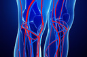 Dor, incha&ccedil;o ou varizes? Descubra quando a ecografia vascular pode fazer a diferen&ccedil;a