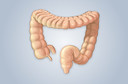 Lavagem intestinal - por que fazer e por que não fazer?