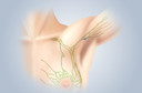 Linfonodo sentinela: o que &eacute;? Quando deve ser retirado?